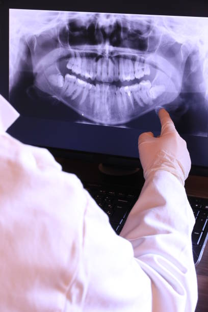 Best Emergency Root Canal Treatment in Factoryville, PA