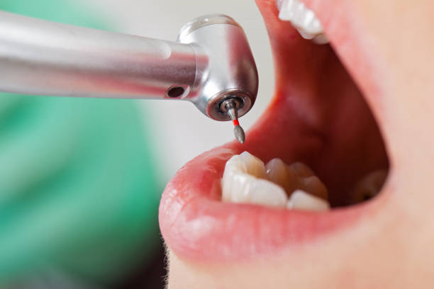 Best Cosmetic Emergency Dentistry in Factoryville, PA